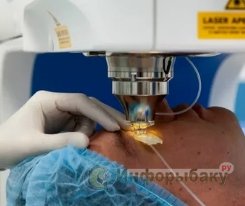 Лазерная коррекция зрения Лазерная коррекция зрения